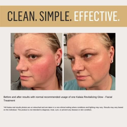 Smooth skin with olive oil peel. - Image 2