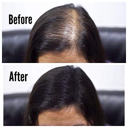 Toppik Beard Filler Spray for Patchy Beards - 2 oz Capacity - Image 6