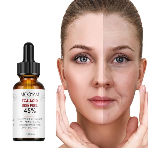 45% Citric Acid Serum for Acne and Dark Spots
