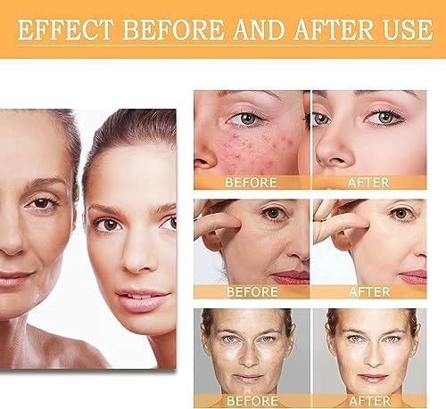 Glycolic Acid 7% Acne and Blemish Treatment Toner, 6.7 oz Bottle - Image 3