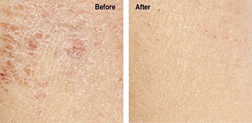 Pure Argan Oil for Skin Hydration Wrinkle Reduction 4 oz Bottle - Image 4