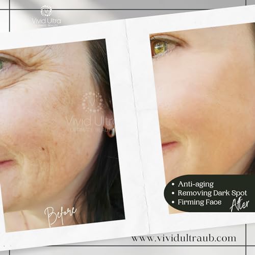 Vivid Ultra Vitamin C Serum ? Anti Aging & Acne - Image 6