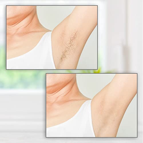 Dual Electric Wax Heater for Hair Removal & Paraffin SPA with 100 Applicator Sticks - Image 9