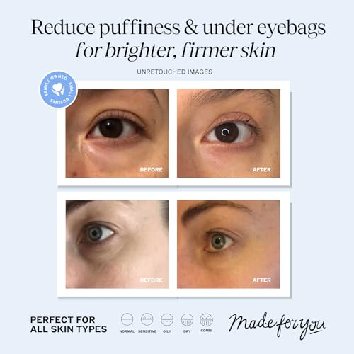 LilyAna Naturals Eye Cream for Dark Circles, Puffiness, and Wrinkles - 1 oz - Image 2