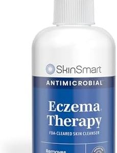 SkinSmart Eczema Therapy Spray with Hypochlorous Acid, 8oz for All Ages