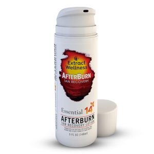 AfterBurn Tan Recovery Lotion – Doctor-Formulated Aftersun with Natural Ingredients & Oils