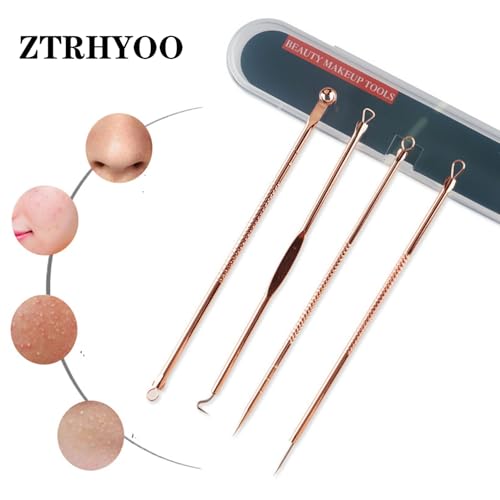 4-Piece Rose Comedone Extractor Kit for Safe Acne Removal with Case - Image 3