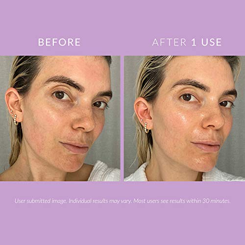 Kate Somerville DeliKate Recovery Cream for Sensitive Skin Redness, 1.7 oz - Image 7