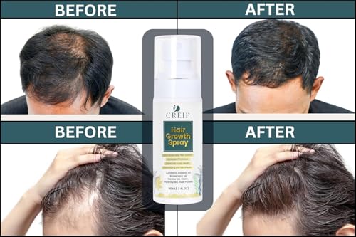 2 FL OZ Hair Growth Spray: Natural Batana, Castor, Rosemary Oil & Biotin - Image 5