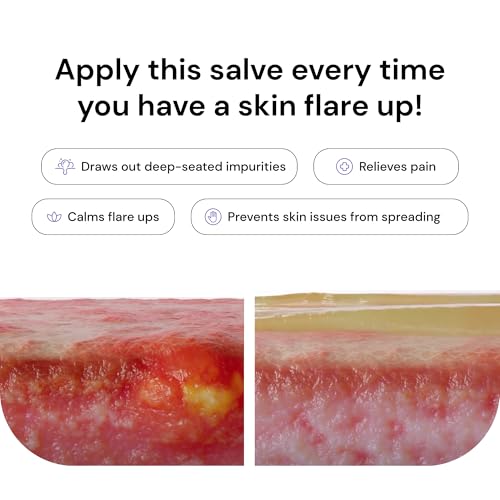 Natural Beeswax and Propolis Salve for Skin Ailments, 2 oz Jar - Image 7
