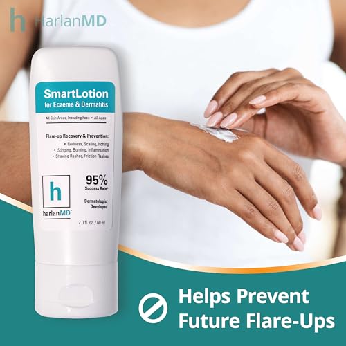 SmartLotion Cream for Dermatitis & Eczema, 2 Fl Oz, Prebiotic Formula - Image 4
