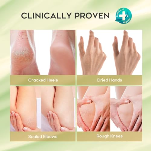 Urea 42% Foot Cream for Callus Removal and Deep Moisturizing - Image 4