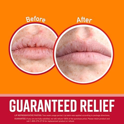 O'Keeffe's Cherry & Vitamin E Lip Repair Balm, Stick (Pack of 3) - Image 2