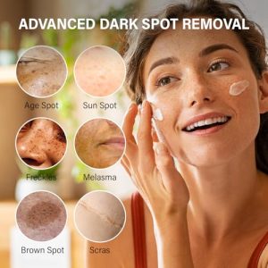 Advanced Dark Spot Remover for Face & Body - 50ML, Fades Age Spots & Freckles