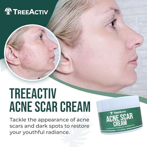 TreeActiv 2 fl oz Acne Scar Cream for Face and Body Treatment - Image 2
