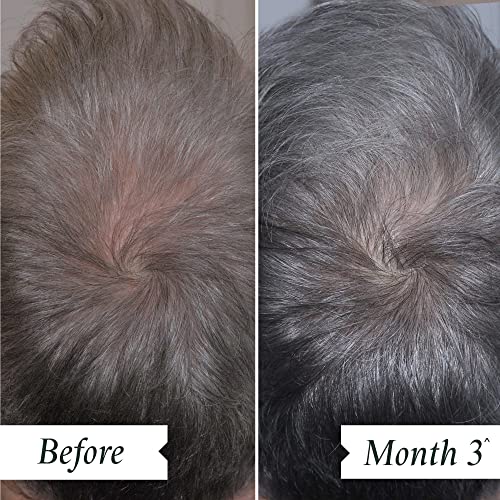 Philip Kingsley Density Serum for Thinning Hair & Scalp Care, 2.87 oz - Image 2