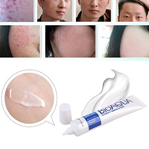 BIOAQUA 30g Anti-Wrinkle Acne Cream for Spots, Scars, and Blemishes - Image 4