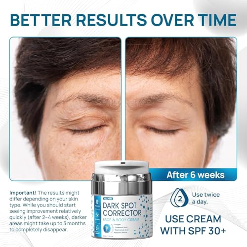 Dark Spot Corrector Cream with Collagen & Niacinamide, 1.85 fl oz, Hyperpigmentation Treatment - Image 3