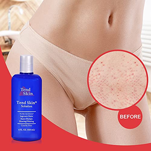 Tend Skin Women's 4 oz Ingrown Hair and Razor Bump Aftershave Solution - Image 6