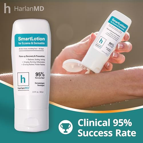 SmartLotion Cream for Dermatitis & Eczema, 2 Fl Oz, Prebiotic Formula - Image 2
