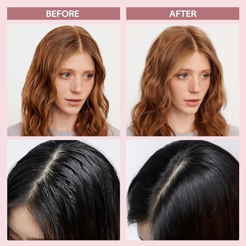 Ynalo Travel Size Dry Shampoo Powder 2 Pack - Non-Aerosol, No White Cast Formula - Image 2
