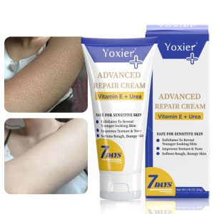 Strawberry Legs Moisturizing Cream for Women, Smooths Rough Bumpy Skin
