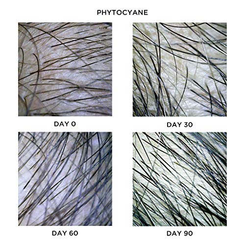 PhytoCyane Treatment for Women's Reactional Hair Thinning - Image 3