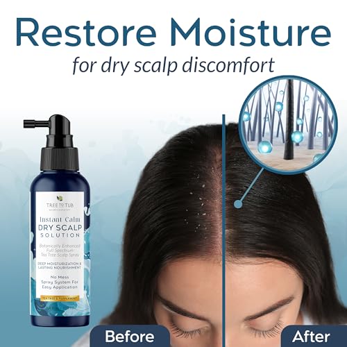 Tree To Tub Tea Tree Scalp Moisturizer Spray ? Dry Scalp Care - Image 2