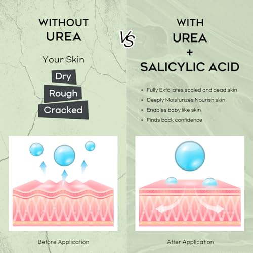 Urea 42% Foot Cream for Callus Removal and Deep Moisturizing - Image 6