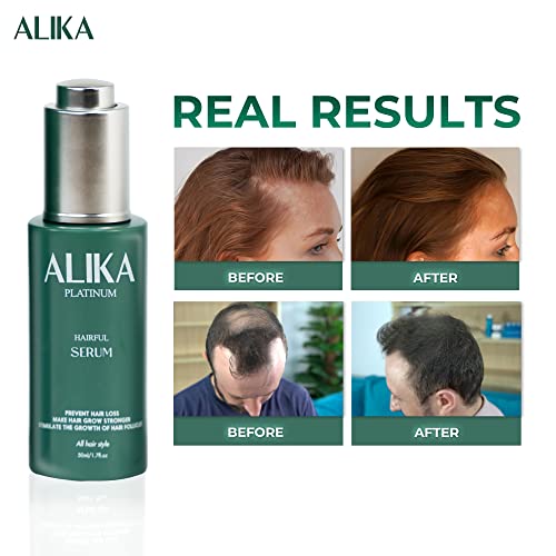 ALIKA Hair Growth Serum 50ml Treatment for All Scalp Types and Hair Loss - Image 3