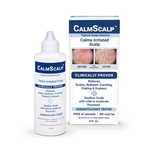 Topical Solution for Mild to Moderate Psoriasis on Scalp - 4 oz, USA Made