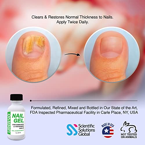 Urea Nail Gel - Softens Calluses, Repairs Fungal Nails, Quick-Dry Treatment, USA Made - Image 2