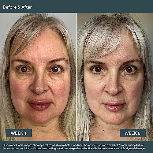 No7 Future Renew Duo: Serum & Night Cream (2 Count) - Image 4