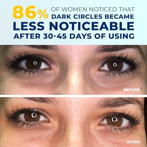 4-in-1 Under Eye Brightener with Niacinamide & Caffeine - Image 7