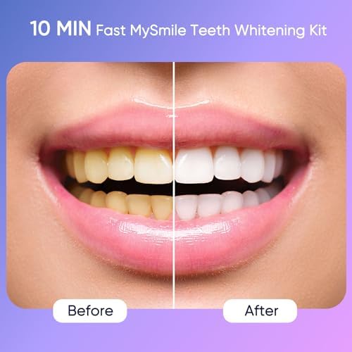 MySmile Deluxe 10 Min Whitening Kit with LED Light - Image 2