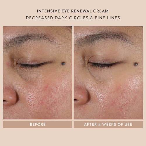 Shani Darden Skincare Renewal Trio Set Retinol Cream and Eye Cream 3-Piece - Image 5