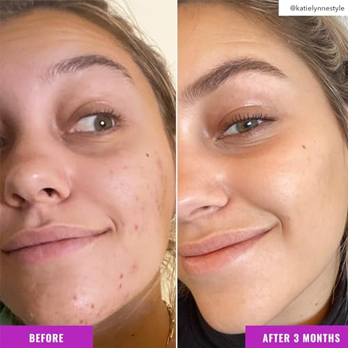 Good Molecules Niacinamide Brightening Facial Toner - Image 5