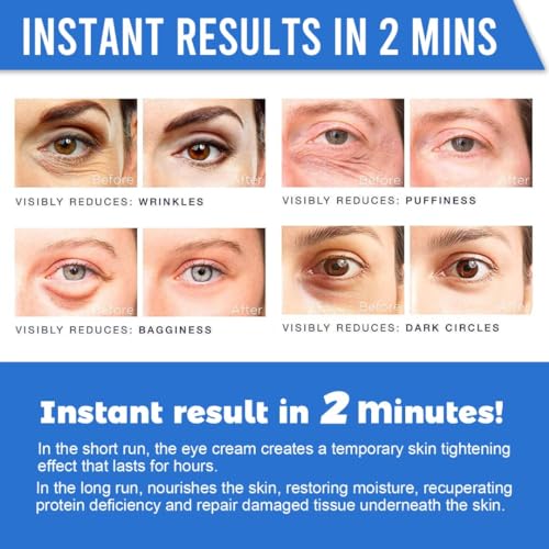 Revitalizing Eye Cream: Hyaluronic Acid, Caffeine, Green Tea 1 oz - Image 4