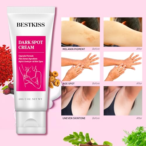 Dark Spot Corrector Cream with Niacinamide for Face & Body - Image 4
