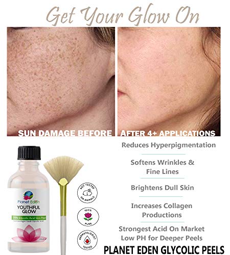 Planet Eden 40% Glycolic Peel Kit with Recovery Cream - Image 3