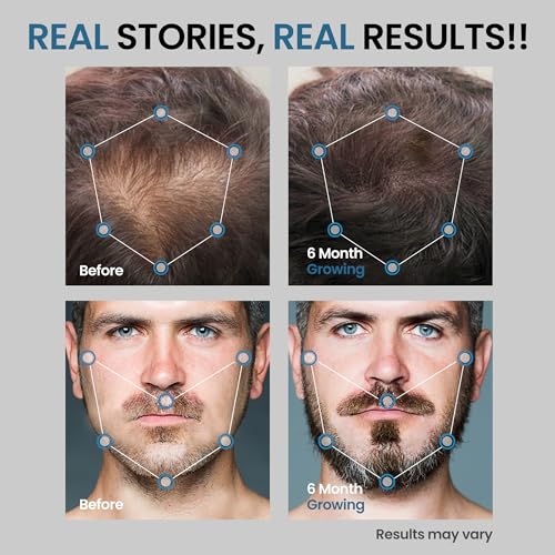 2 Pack 5% Minoxidil Hair Growth Serum for Men 120ml Total Volume - Image 3