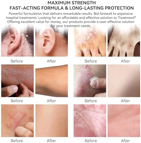 Nourishing Skin Treatment Cream for Adults and Children, Soothing Relief - Image 5