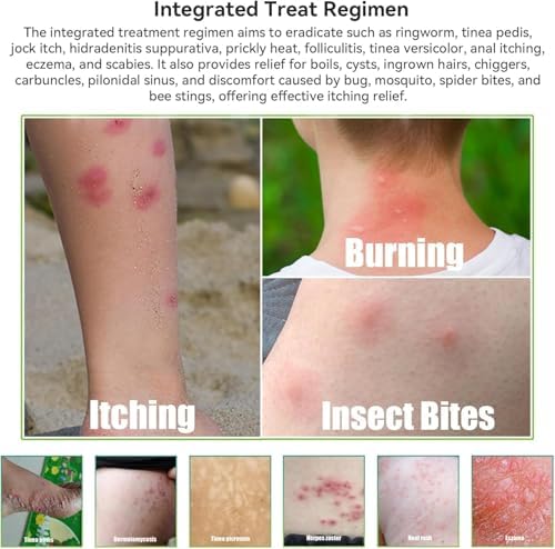 Nourishing Skin Treatment Cream for Adults and Children, Soothing Relief - Image 8