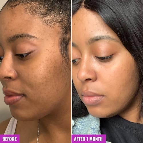 Glycolic Exfoliating Toner with Hyaluronic Acid & Aloe - Image 5