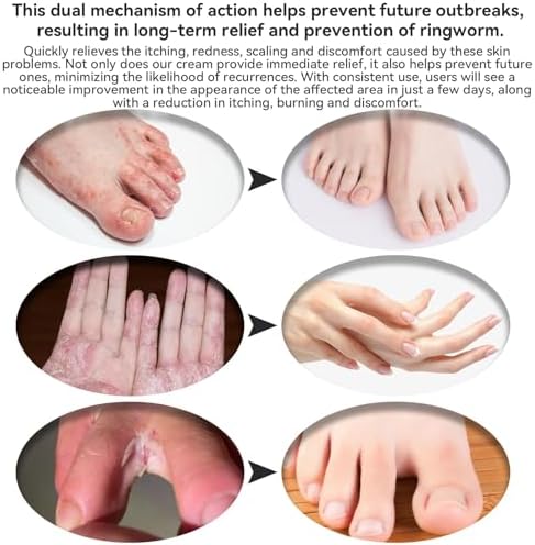 Nourishing Skin Treatment Cream for Adults and Children, Soothing Relief - Image 4