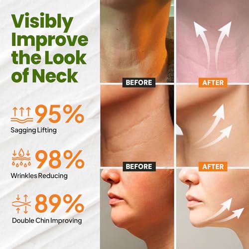 Firming Neck Cream with Retinol & Hyaluronic Acid ? 1.7 oz - Image 4