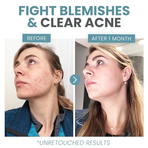 Vitamin C Serum with Hyaluronic Acid & Retinol (2 oz) - Image 6