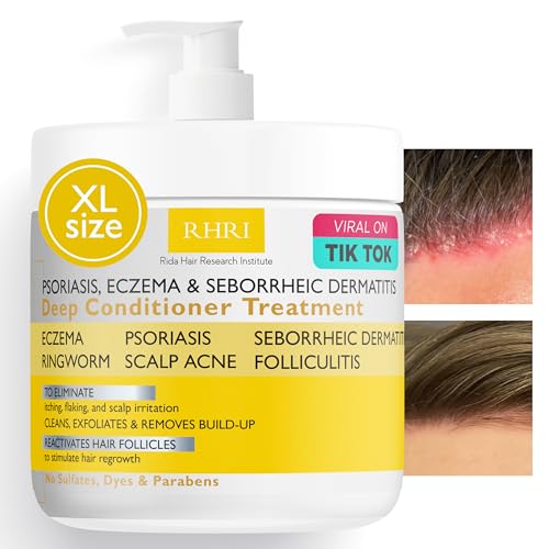 Antifungal Deep Conditioner for Psoriasis, Eczema & Dermatitis