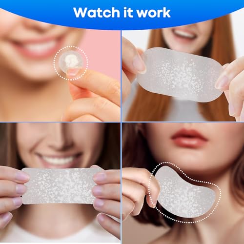 Large Hydrocolloid Pimple Patches with Tea Tree & Salicylic Acid - Image 6