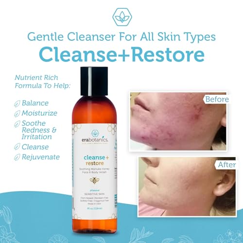 Manuka Honey Face Wash ? Moisturizing Cleanser with Aloe Vera - Image 5